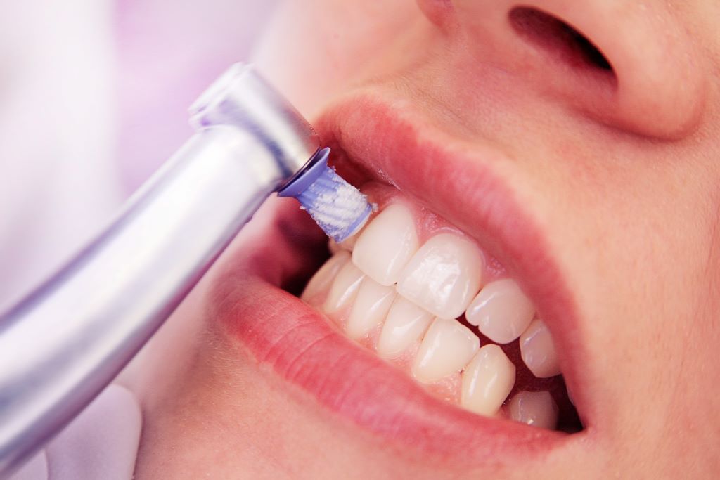Limpeza Dental Completa - Dente Sim
